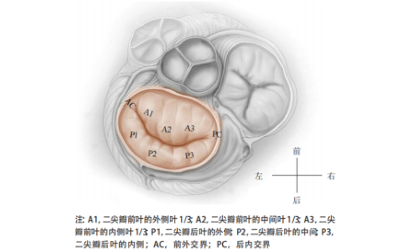 醫(yī)療器械備案注冊(cè)代辦—經(jīng)導(dǎo)管二尖瓣夾系統(tǒng)臨床評(píng)價(jià)審評(píng)概述及審評(píng)關(guān)注點(diǎn)
